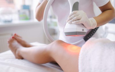 Radio Frequency Body Skin Tightening