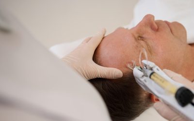 What Is Mesotherapy Bio-Revitalisation? Can It Improve Your Skin?
