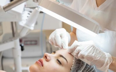 What Are Milia & How Can They Be Safely Removed?