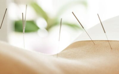 Acupuncture Awareness Week