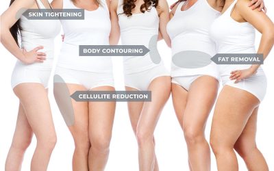 Body Contouring Without Surgery: What Are Your Options?