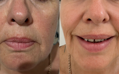Anti-Ageing Treatments Case Study
