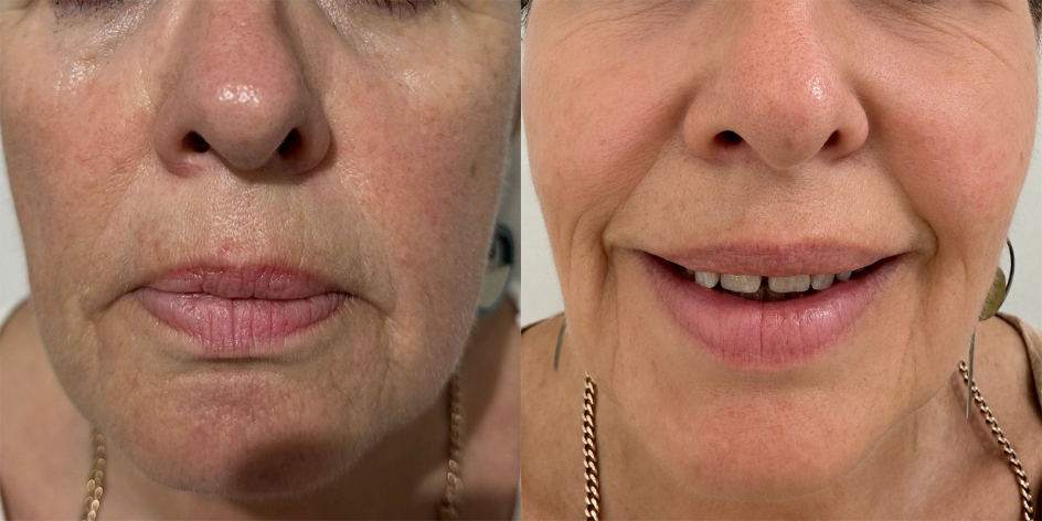 Anti-ageing Treatments