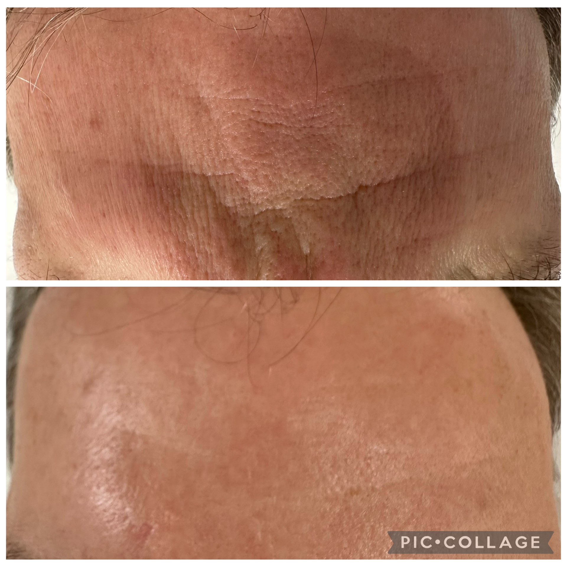 importance of sunscreen
