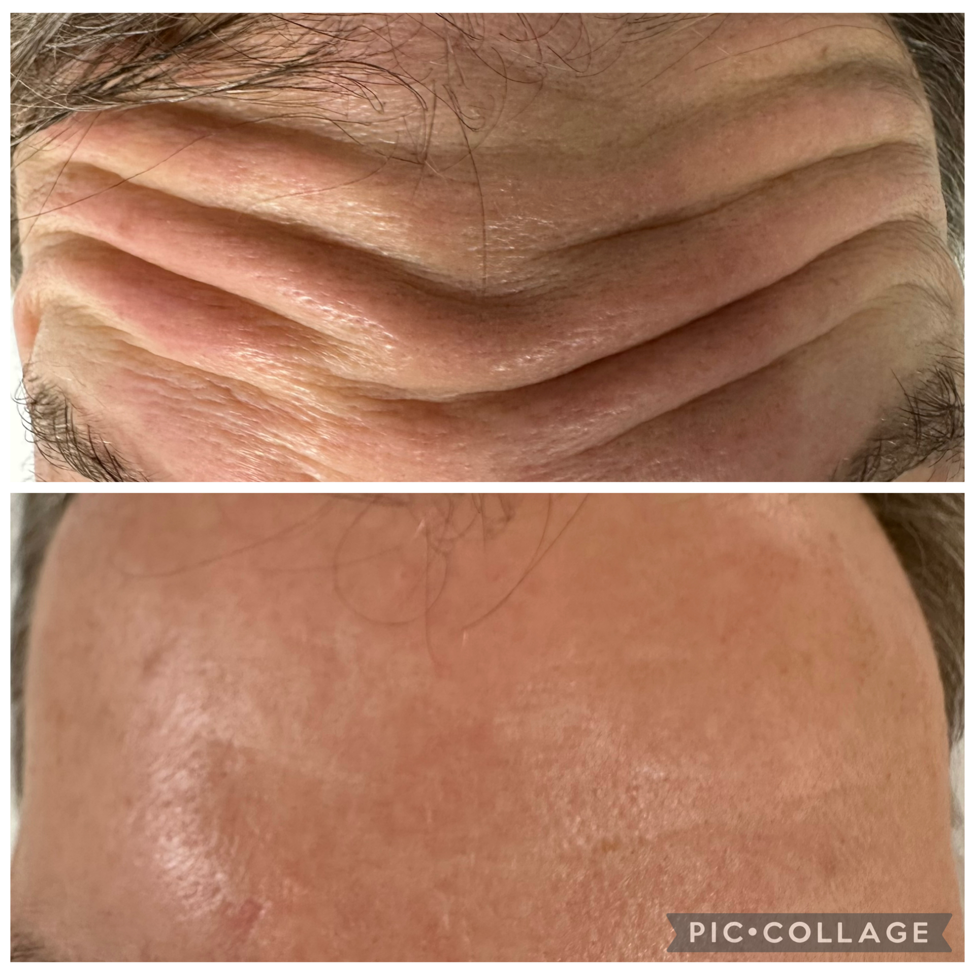 protection from UV